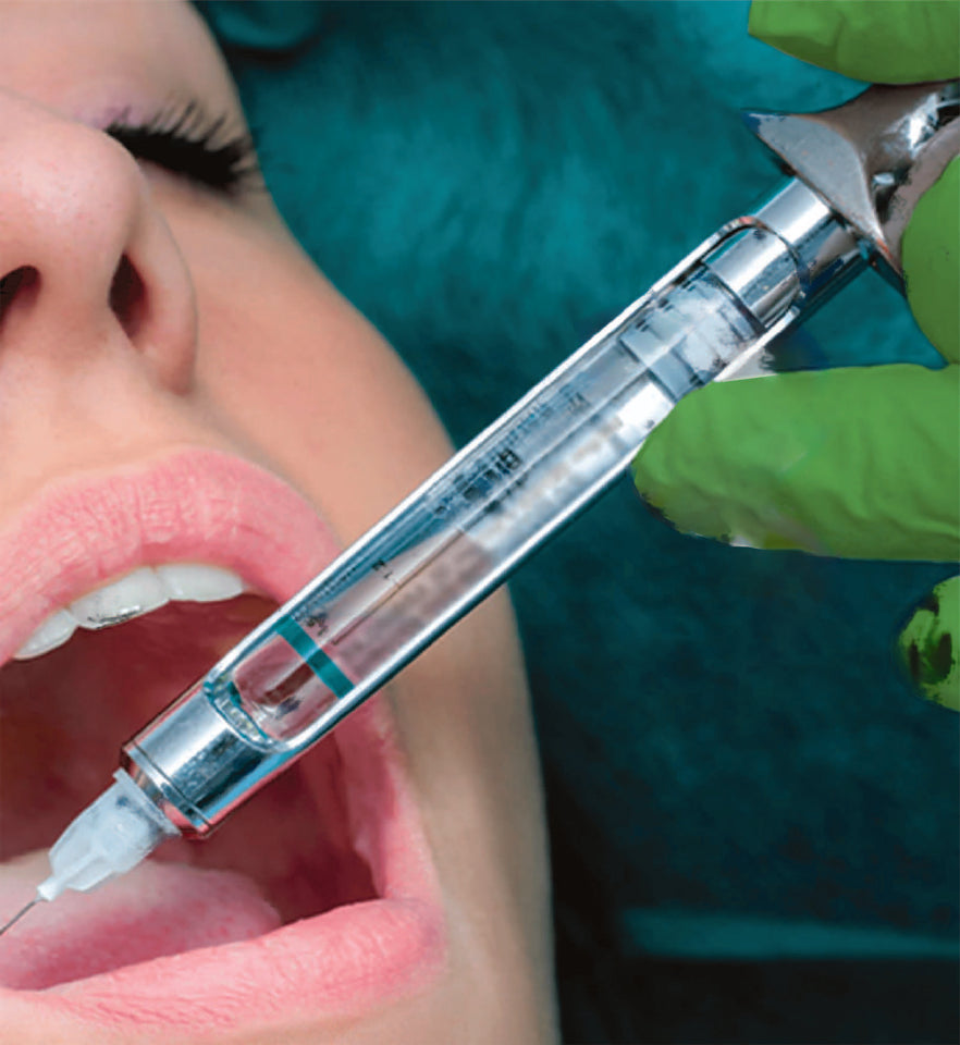 Onpharma Onset Buffering System - Local Anesthetic Buffering – Onpharma ...